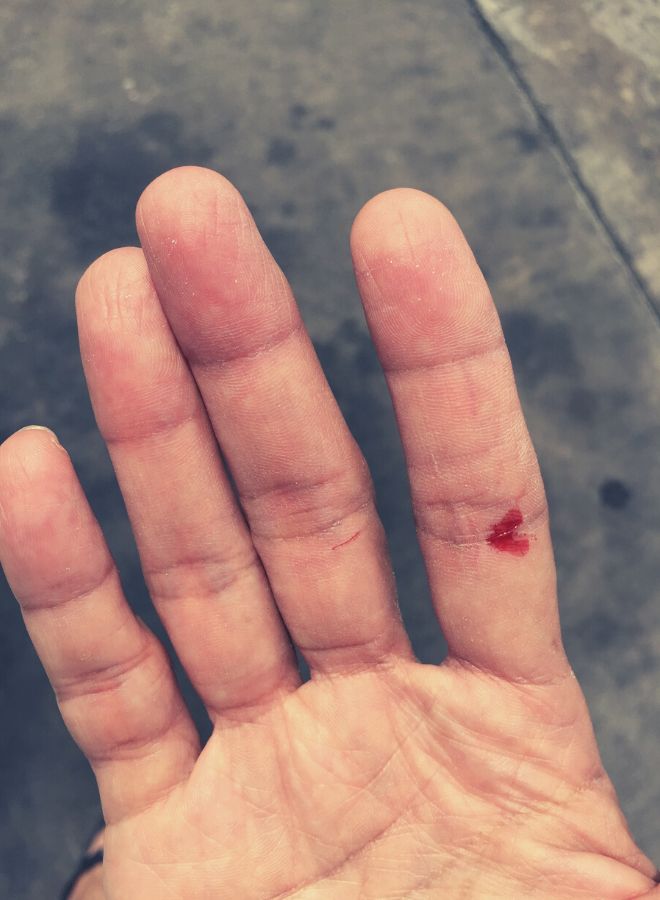 The Symbolism of Bleeding Fingers
