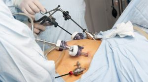 Dream About Surgery on Stomach